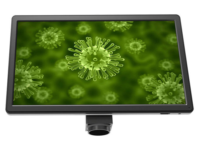 完全なHD 16 MPの顕微鏡の付属品LCDスクリーンUOP XSP-16.0の黒